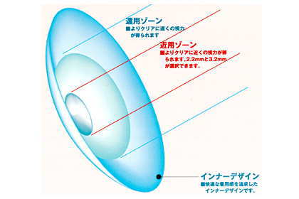アイミーバイフォーカルソフト同心円型デザイン